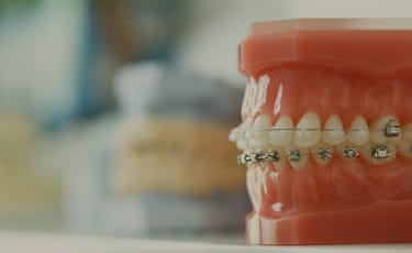 咬み合わせに調和した矯正